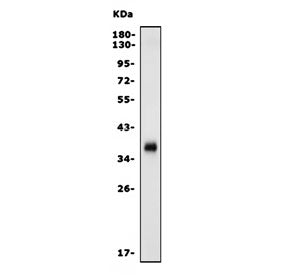 Programmed death ligand 1 Antibody / Pd-l1 / B7-h1 / Cd274