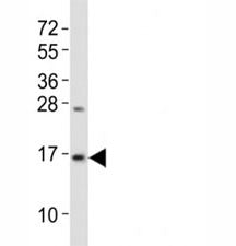 Western blot testing of LC3B antibody at 1:2000 dilution + mouse brain lysate; Predicted band size :