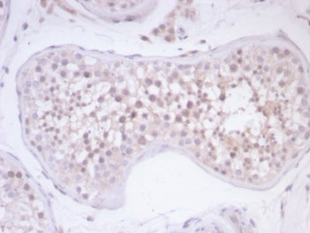 IHC staining of FFPE human testis tissue with Survivin antibody (clone BIRC5/7778). HIER: boil tissu