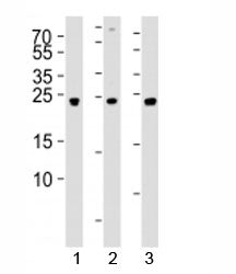 UCHL3 Antibody