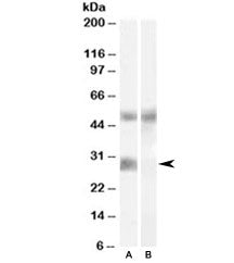 IGFBP3 Antibody
