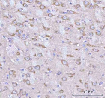 IHC staining of FFPE rat brain tissue with Rabphilin 3A antibody. HIER: boil tissue sections in pH8
