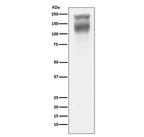 CEA Antibody / Carcinoembryonic Antigen