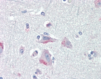 CRF1 Antibody