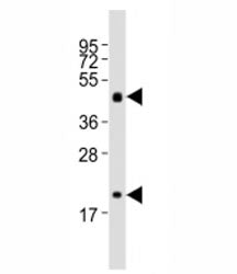 Western blot testing of Shh antibody at 1:2000 dilution + mouse stomach lysate; Predicted molecular