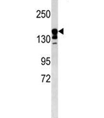 ABCC9 antibody western blot analysis in mouse kidney tissue lysate. Predicted molecular weight ~174