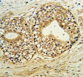 Phospholipid-transporting ATPase IG Antibody / ATP11C