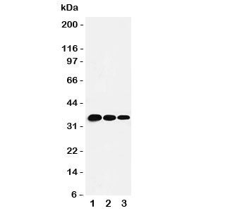 T-bet Antibody (TBX21)