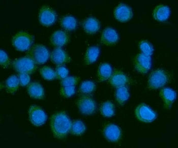 PDGFA Antibody / Platelet Derived Growth Factor A / PDGF AA