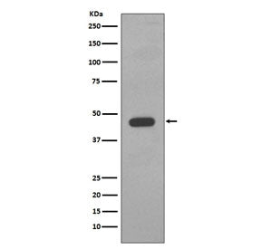 Cytokeratin 14 Antibody / CK14 / KRT14