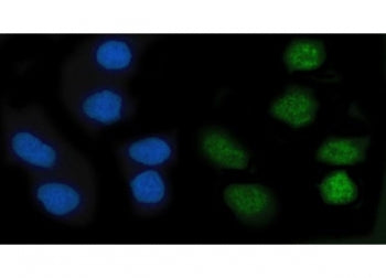 KLF10 Antibody / Krueppel-like factor 10 / TIEG-1