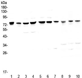 Western blot testing of human 1) HeLa, 2) placenta, 3) COLO-320, 4) HepG2, 5) PANC-1, 6) SGC-7901, 7