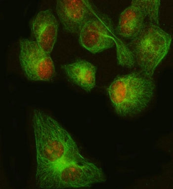 Immunofluorescent staining of FFPE human HeLa cells with FOXP1 antibody (red) and Beta Tubulin antib