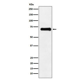 Western blot testing with phospho-PAK4/5/6 antibody. Predicted molecular weight ~64 kDa (PAK4), ~81