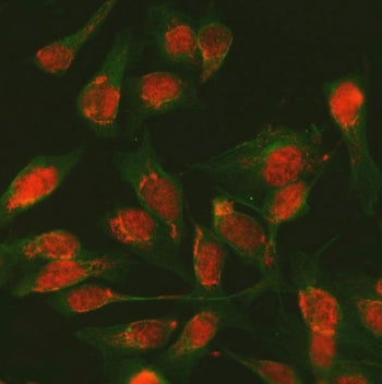Immunofluorescent staining of FFPE human U-2 OS cells with SDE2 antibody (red) and Alpha Tubulin mAb