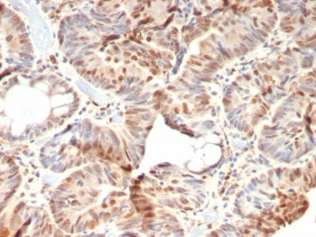 Retinoblastoma Antibody / Rb1