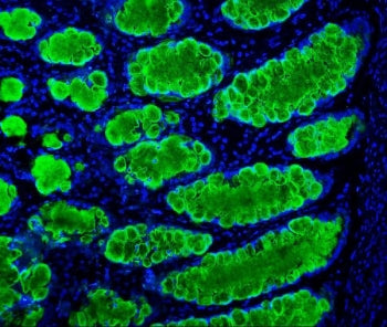 MUC2 Antibody / Mucin 2