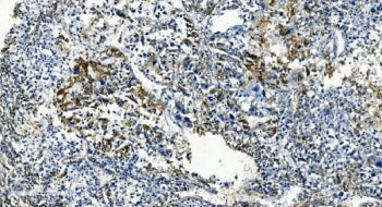TMBIM1 Antibody