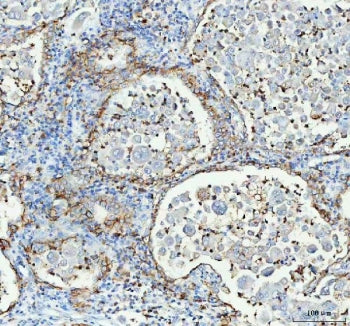 Aquaporin 4 Antibody / AQP4