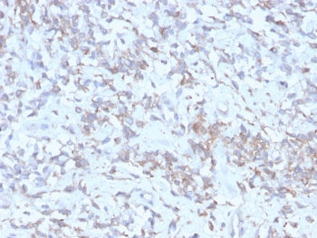 RBP Antibody / Retinol Binding Protein 1