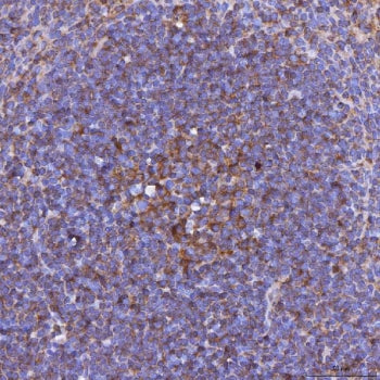 Light Antibody / Tnfsf14