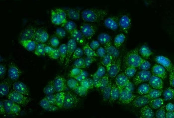 TBX4 Antibody / T-box protein 4
