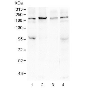 SI Antibody / Sucrase Isomaltase