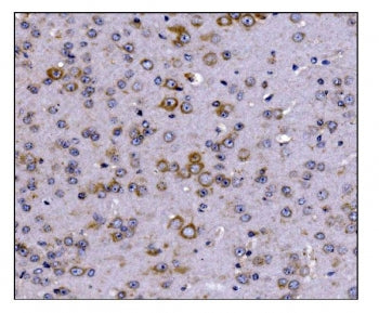 IHC staining of FFPE mouse brain tissue with SCN1B antibody. HIER: boil tissue sections in pH8 EDTA