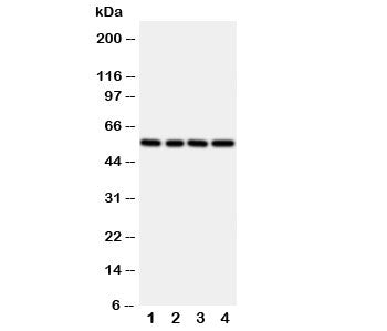 Western blot testing of TXNRD2 antibody and rat samples 1: kidney; 2: ovary; 3: liver; 4: human SMMC