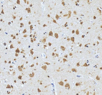 IHC staining of FFPE human brain tissue with PRMT8 antibody. HIER: boil tissue sections in pH8 EDTA