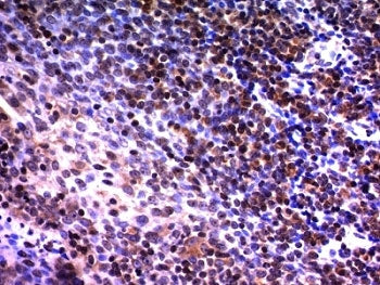 IHC analysis of formalin-fixed, paraffin-embedded human tonsil stained with NuMA antibody (clone A73