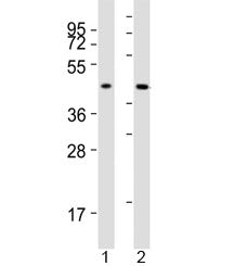 ACAT1 Antibody
