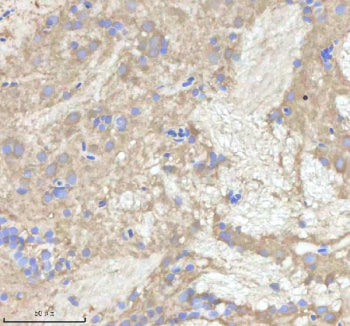 IHC staining of zebrafish Npepps protein using Zebrafish Npepps antibody, HRP-labeled secondary and