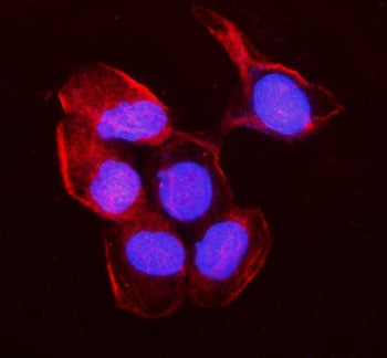MYH10 Antibody / non-muscle Myosin IIB