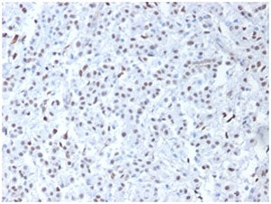 WT1 Antibody / Wilms Tumor 1