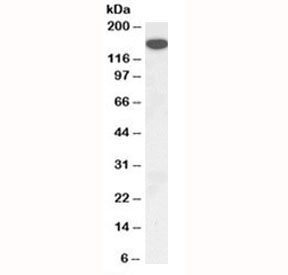 Thrombospondin Antibody