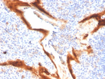 IL1RA Antibody / Interleukin-1 Receptor Antagonist / IL1RN