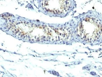 Prolactin Receptor Antibody Cocktail