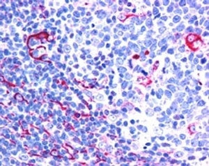 NET1 Antibody