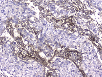 Collagen IV Antibody