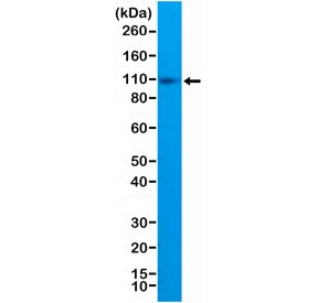 CD10 Antibody / Neprilysin / Cytoplasmic domain
