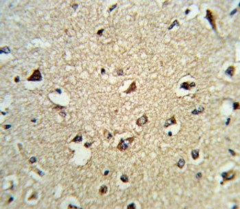 ARHGDIA Antibody / RHOGDI Antibody