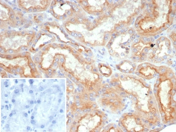 IHC staining of FFPE human kidney tissue with Ob-R antibody (clone LEPR/4545). Inset: PBS used in pl
