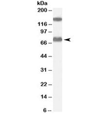 ACOX2 Antibody