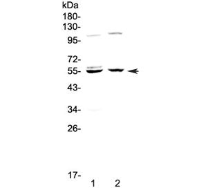 Caspase 8 Antibody (small subunit)