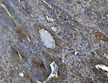 ACVRL1 Antibody / ALK1