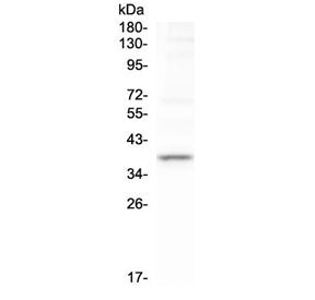 TAL1 Antibody / T-cell acute lymphocytic leukemia protein 1