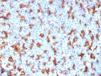 IHC testing of FFPE human tonsil with CD11c antibody (clone ITGAX/2507). Required HIER: boil tissue
