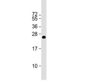 Western blot testing of a recombinant human partial protein with MLL3 antibody. Predicted molecular