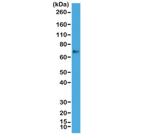 p63 Antibody / Tumor protein 63